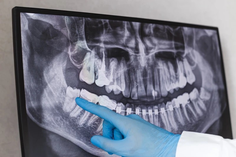 Lettura di una radiografia panoramica su monitor nello studio dentistico a Pomezia